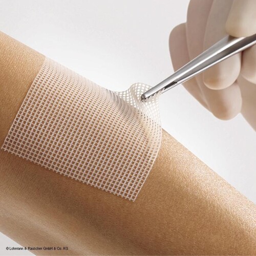 Lomatuell PRO Polyesterfaser-Gittertüll steril, 5 x 5 cm (8 Stck.) (PACK=8 STÜCK) Produktbild Front View L