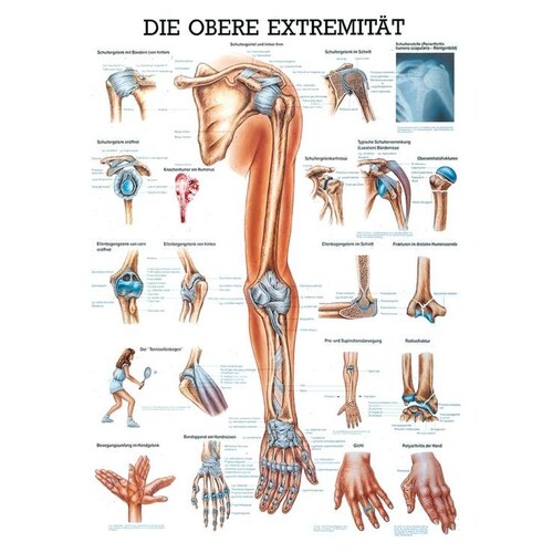 anat. Mini-Poster: obere Extremität 24 x 34 cm, laminiert Produktbild Front View L