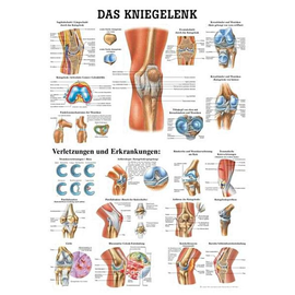 anat. Lehrtafel: Das Kniegelenk 70 x 100 cm, Papier Produktbild