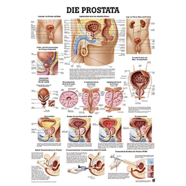 anat. Lehrtafel: Die Prostata 70 x 100 cm, Papier Produktbild