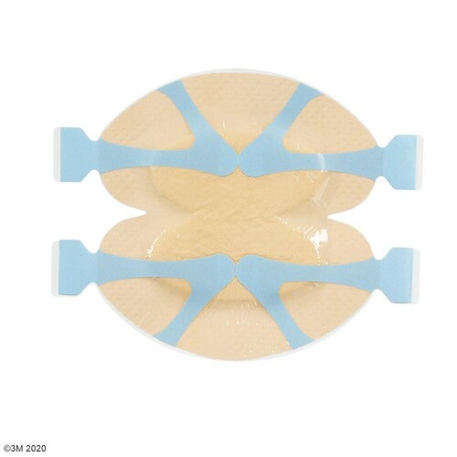 3M Tegaderm Silicone Foam Border Schaumverband 16,5 x 16,5 cm (5 Stck.) (PACK=5 STÜCK) Produktbild Front View L